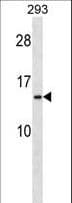 RPS20 / Ribosomal Protein S20 Antibody (aa26-55)