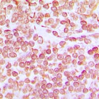 Polyclonal Rabbit anti-Human POU2F1 / OCT1 Antibody (N-Terminus, IHC, WB)