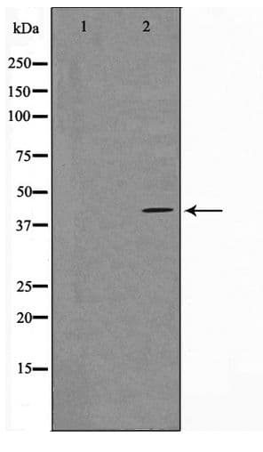 VPS72 Antibody