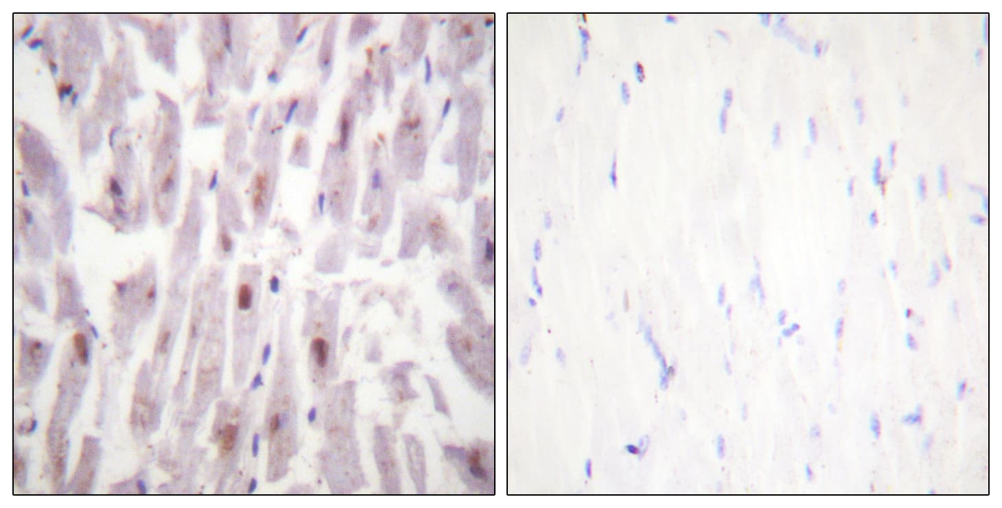 MED1 / TRAP220 Antibody (phospho-Thr1457)