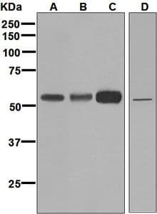IHC-plus™ FADS1 Antibody (Internal, clone EPR6898)