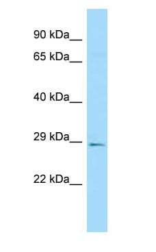 SCG5 / 7B2 Antibody (C-Terminus)