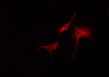 Polyclonal Rabbit anti-Human RPL11 / Ribosomal Protein L11 Antibody (IF, WB)