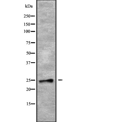 RAB28 Antibody