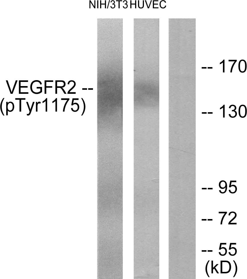 KDR / VEGFR2 / FLK1 Antibody (phospho-Tyr1175)