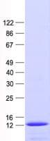 Human RAD51C Protein (Recombinant His, N-Terminal)