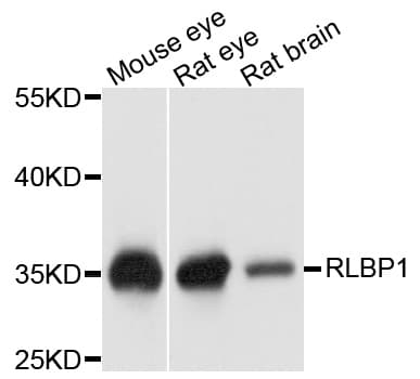 RLBP1 / CRALBP Antibody
