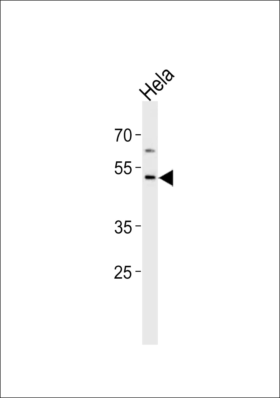 Polyclonal Rabbit anti-Human FUT8 Antibody (aa329-357, IHC, WB)