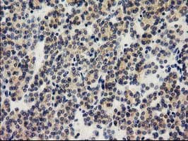 ILVBL Antibody (clone OTI1A12)