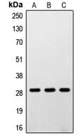 RPS4Y1 Antibody (C-Terminus)