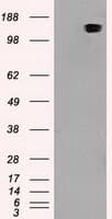 Monoclonal Mouse anti-Human L1CAM Antibody (clone OTI10C12, IHC, WB)