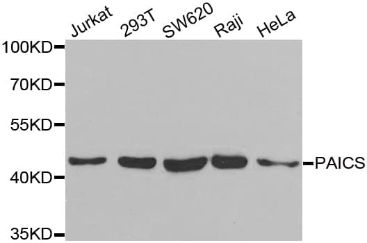 PAICS / ADE2 Antibody