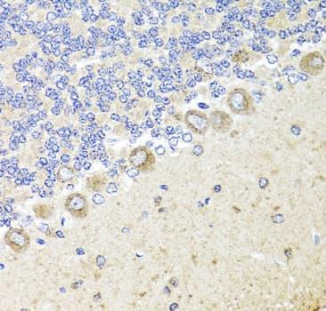 NTRK1 / TrkA Antibody