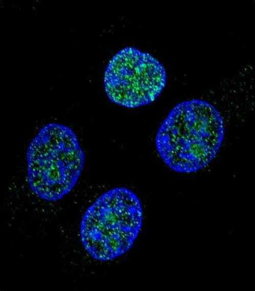 PROC / Protein C Antibody (aa177-206)