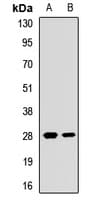 Polyclonal Rabbit anti-Human EIF4E2 / IF4e Antibody (WB)