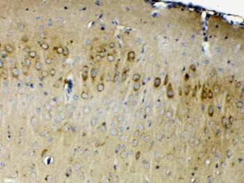 ERBB4 / HER4 Antibody