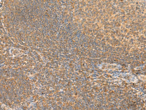 RAC3 Antibody