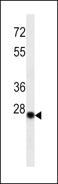 Mouse Anti-Human Kappa Light Chain Secondary Antibody