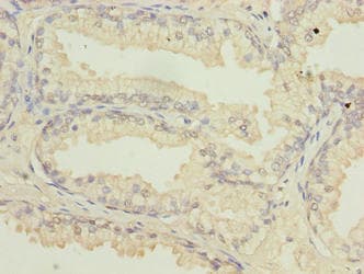 Polyclonal Rabbit anti-Human ATL2 Antibody (IHC, WB)