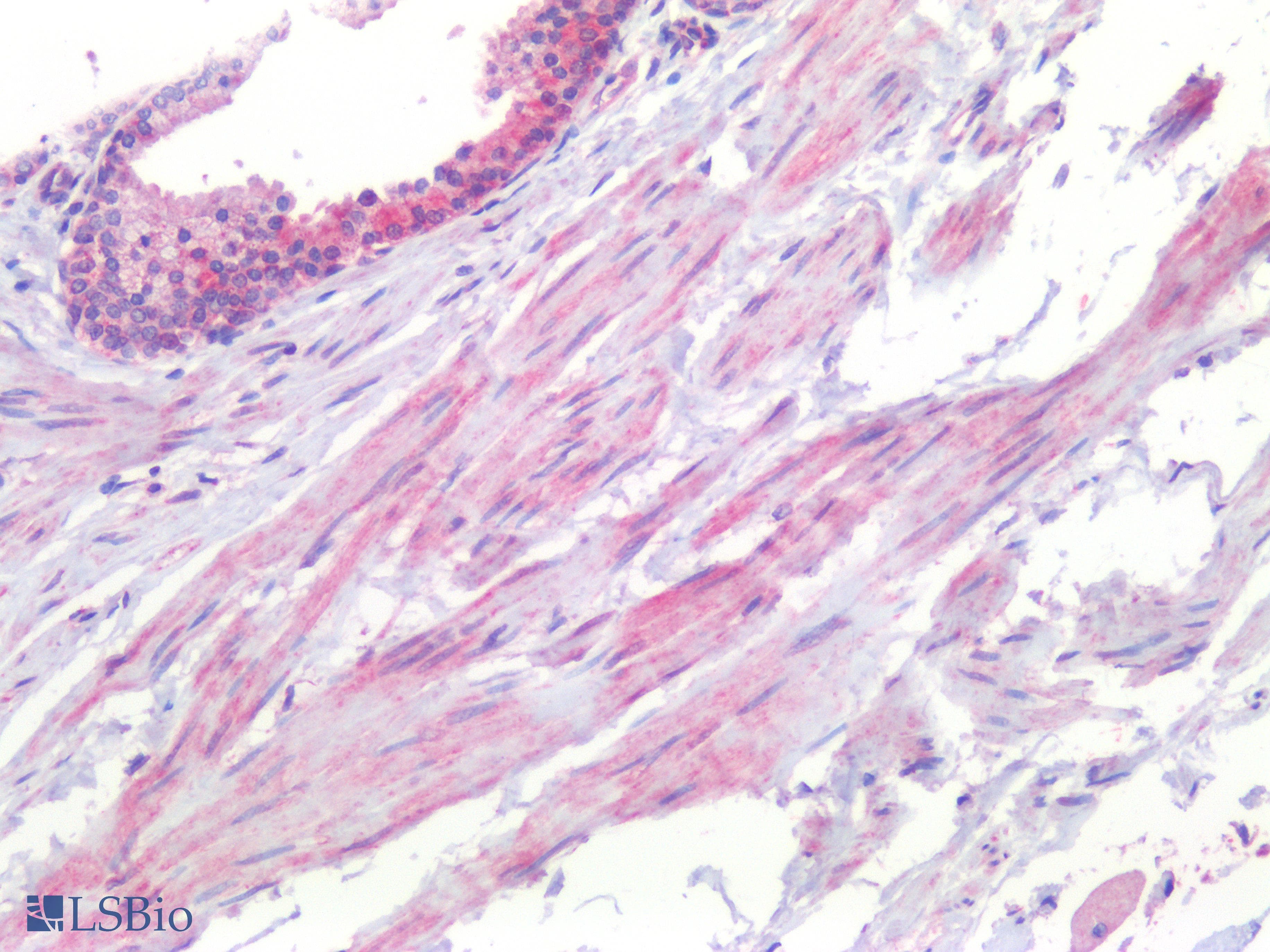 PathPlus™ HTR1B / 5-HT1B Receptor Antibody (Cytoplasmic Domain)