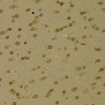 Polyclonal Rabbit anti-Human TMPO / TP / Thymopoietin Antibody (IHC, IF, WB)