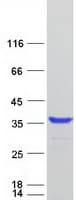 Human FAM125B Protein (Recombinant Myc-DDK (Flag))
