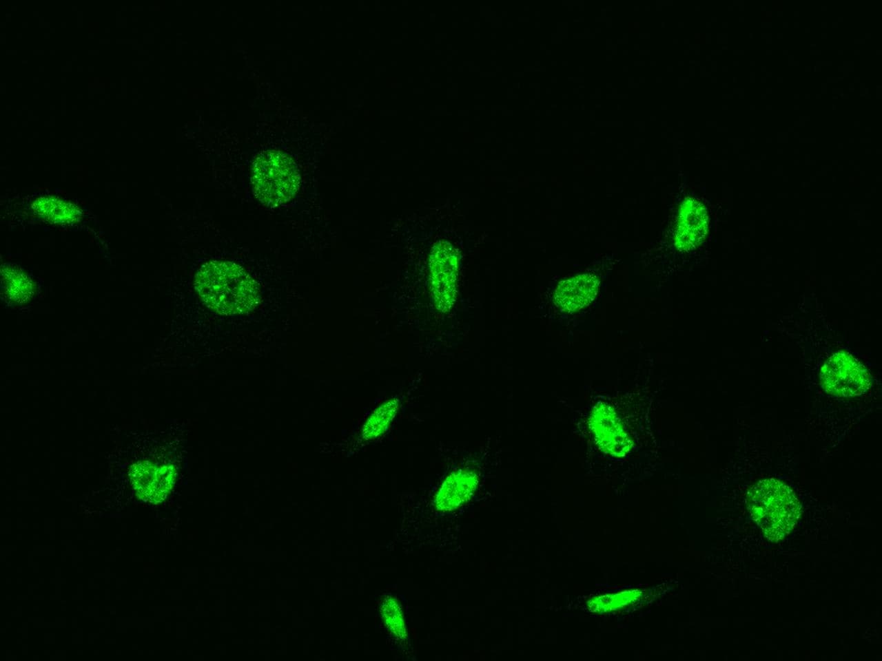 Polyclonal Rabbit anti-Human DAPK3 / ZIP Kinase Antibody (Preservative Free, IHC, IF)