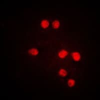 ETV6 / TEL Antibody (aa 396-435)