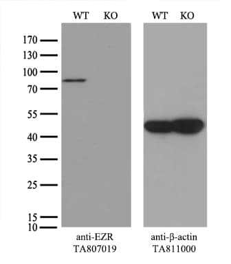 EZR / Ezrin Antibody (clone OTI1F3)