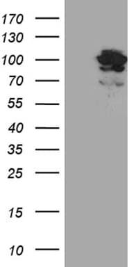 PYGM Antibody (aa698-842, clone OTI5B3, Carrier-free)