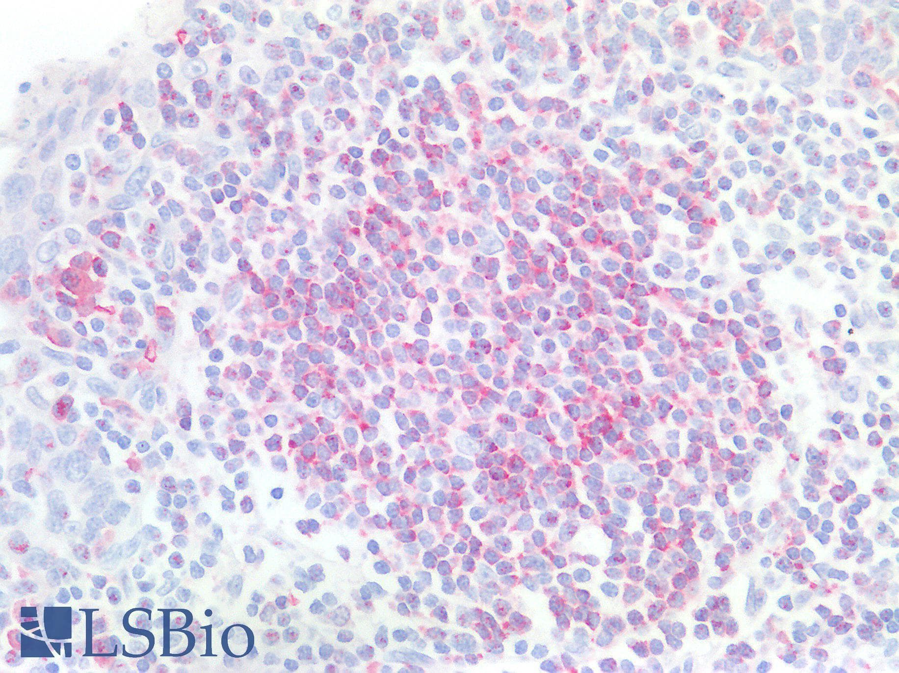 CD79B / CD79 Beta Antibody (Internal)