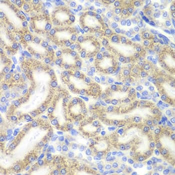 Polyclonal Rabbit anti-Human DAP Antibody (IHC, IF, WB)