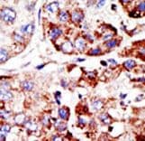 PIAS2 / PIASX Antibody (aa518-547)