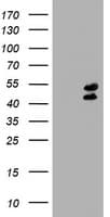 Monoclonal Mouse anti-Human LHX1 Antibody (clone OTI1D1, aa100-362, WB)
