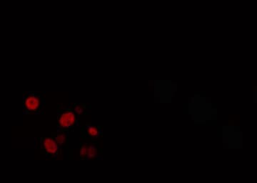Polyclonal Rabbit anti-Human RORC / ROR Gamma Antibody (IHC, IF, WB)