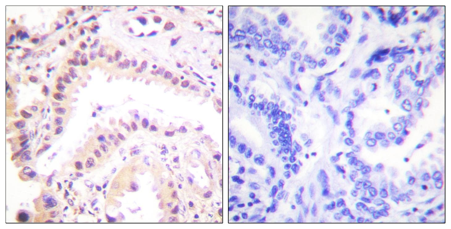 CUL2 / Cullin 2 Antibody