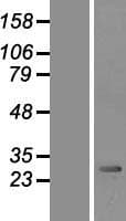 PMM2 Protein (Over-Expression Lysate Myc-DDK (Flag))