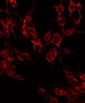 Polyclonal Rabbit anti-Human IL2RB / CD122 Antibody (IF, WB)