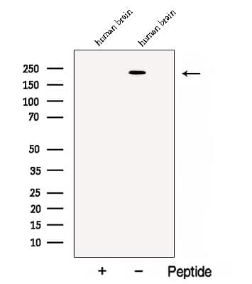 CACNA1S / Cav1.1 Antibody