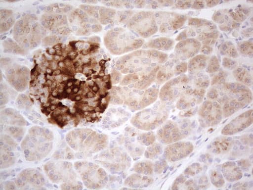 TNFRSF10B / Killer / DR5 Antibody (aa203-411, clone OTI2A5)