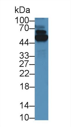 TRXR1 / TXNRD1 Antibody (aa374-577)