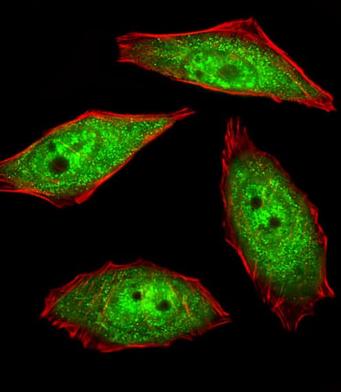 IHC-plus™ NEK2 Antibody (aa396-426)