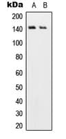 Polyclonal Rabbit anti-Human USP19 Antibody (aa400-439, IHC, WB)