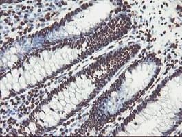 Monoclonal Mouse anti-Human NONO / P54NRB Antibody (clone OTI2E7, IHC, WB)