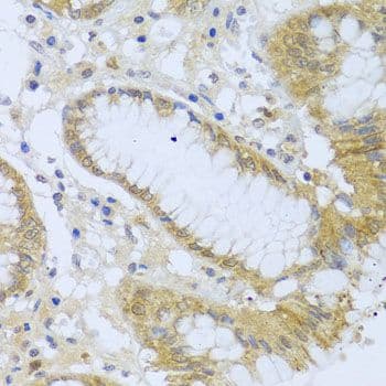 ACP1 / Acid Phosphatase Antibody