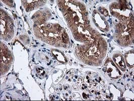 CAT / Catalase Antibody (clone OTI1B8)