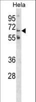 GALNT11 Antibody (aa110-138)