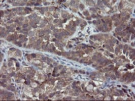 PECAM-1 / CD31 Antibody (clone OTI2C6, Carrier-free)