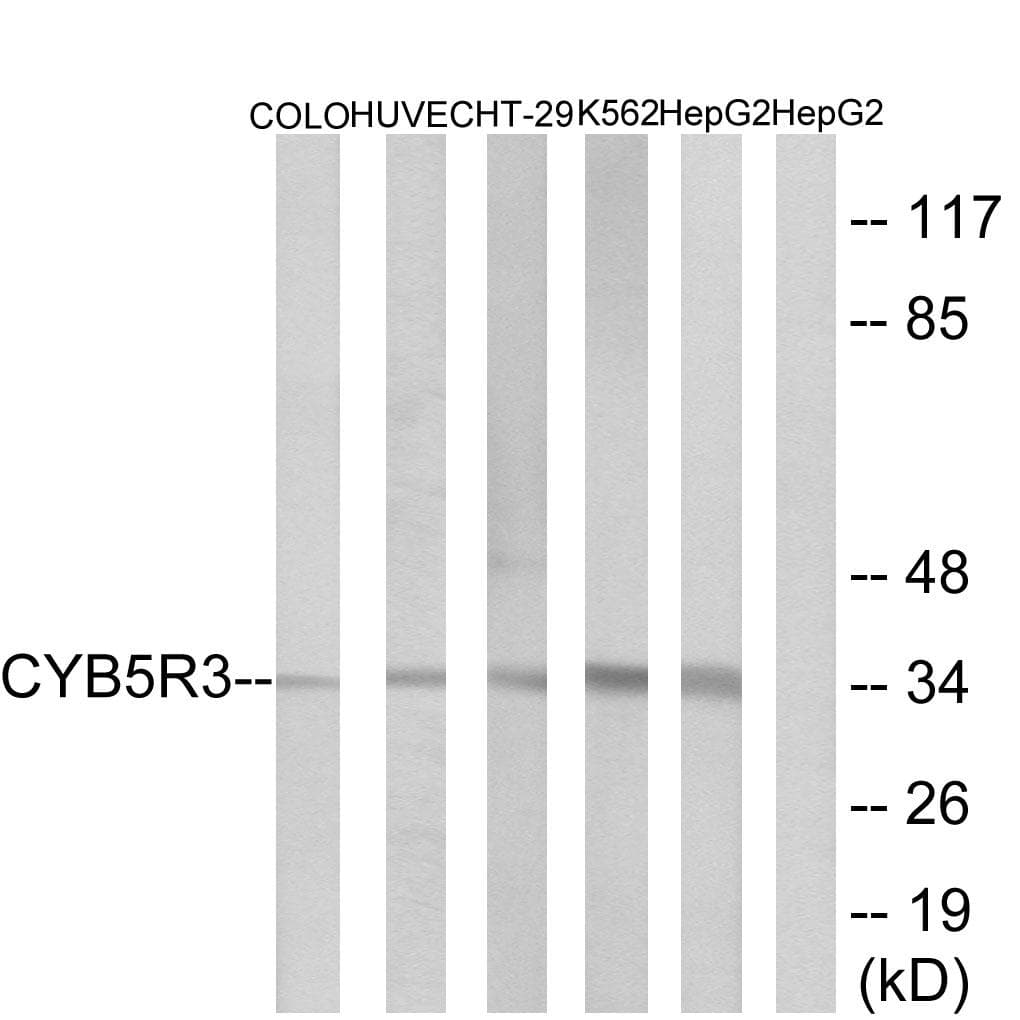 Polyclonal Rabbit anti-Human CYB5R3 / B5R Antibody (IHC, WB)