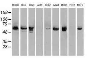 CHEK2 / CHK2 Antibody (clone OTI8D11)